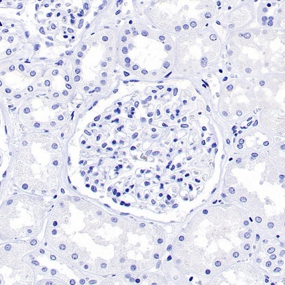FABP7 Recombinant Rabbit mAb (S-762-114)