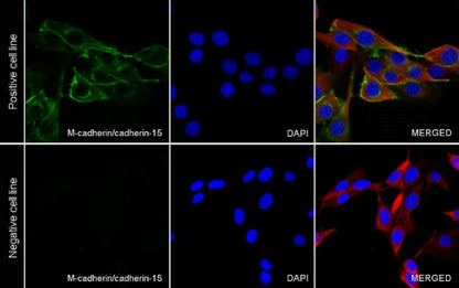 M-Cadherin/Cadherin 15 Recombinant Rabbit mAb (S-2261-74)