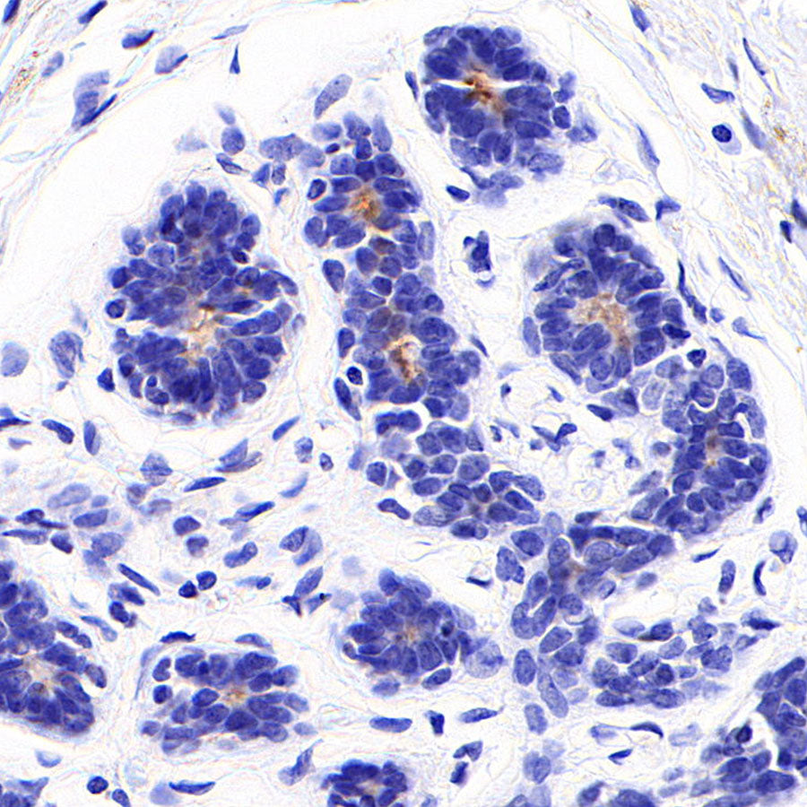 SLC6A14 Recombinant Rabbit mAb (S-5961)