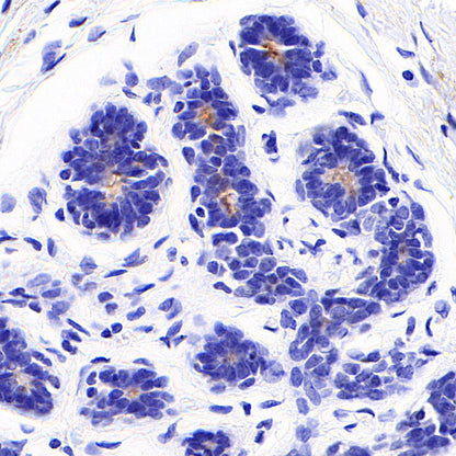 SLC6A14 Recombinant Rabbit mAb (S-5961)
