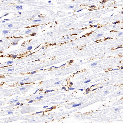 FABP4 Recombinant Rabbit mAb (S-1360-168)