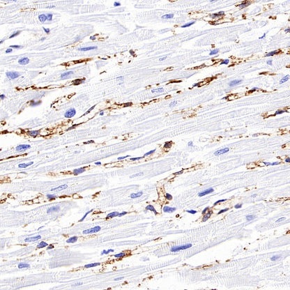 FABP4 Recombinant Rabbit mAb (S-1360-168)