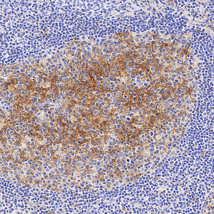CD86 Recombinant Rabbit mAb (S-6175)