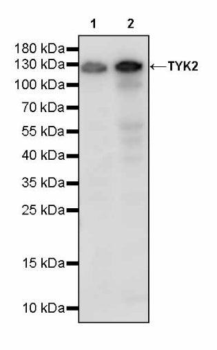 TYK2 Recombinant Rabbit mAb (S-2740-165)