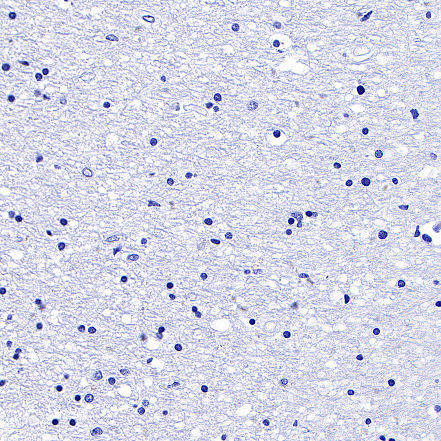 SLC5A1/SGLT1 Recombinant Rabbit mAb (S-4122-30)