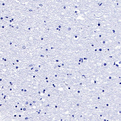 SLC5A1/SGLT1 Recombinant Rabbit mAb (S-4122-30)