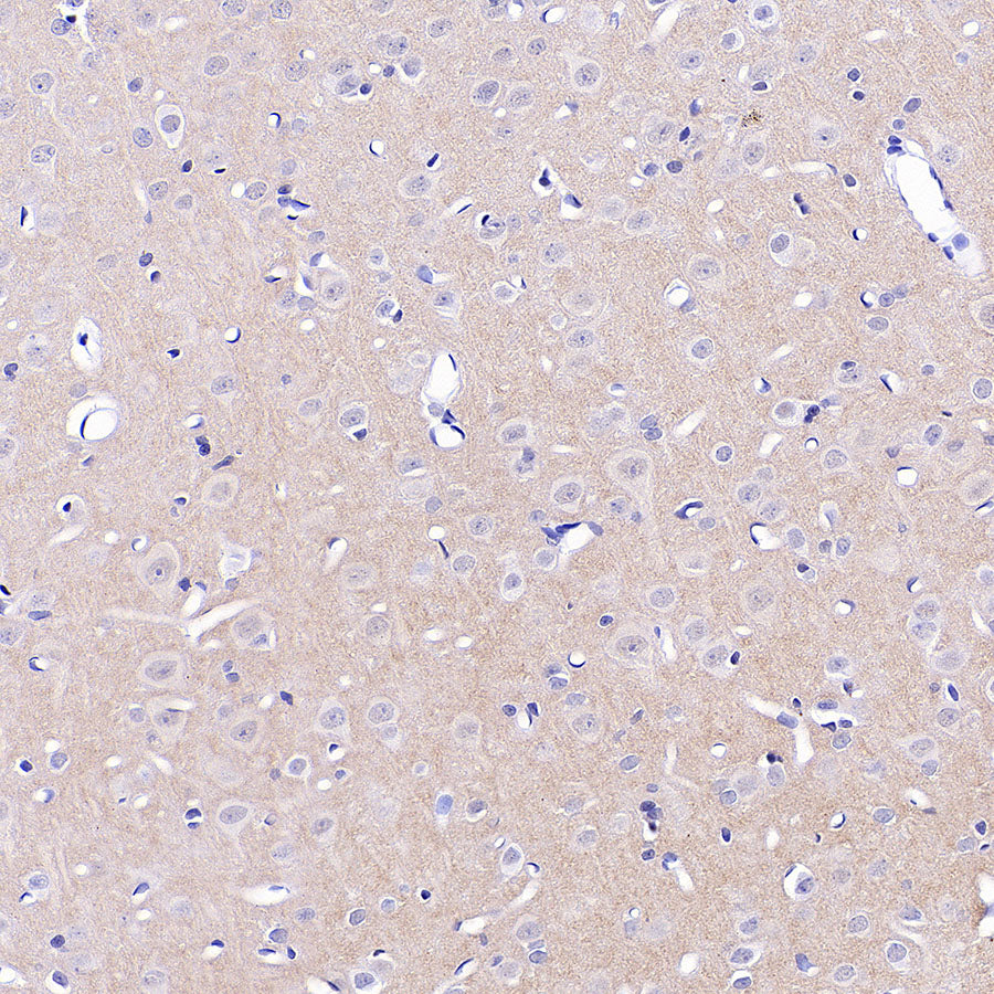 Homer1 Recombinant Rabbit mAb (S-3405-360)