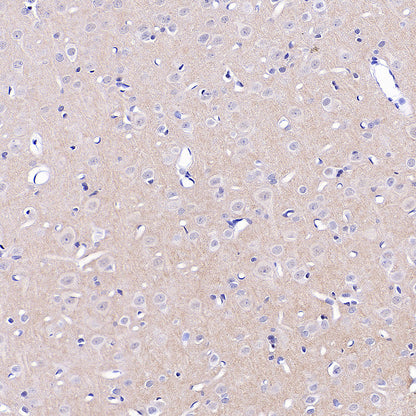 Homer1 Recombinant Rabbit mAb (S-3405-360)