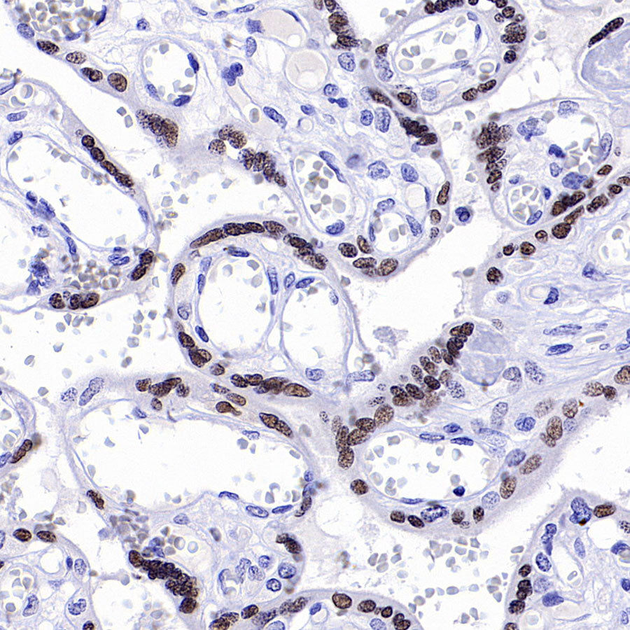 ATF3 Recombinant Rabbit mAb (S-3904)