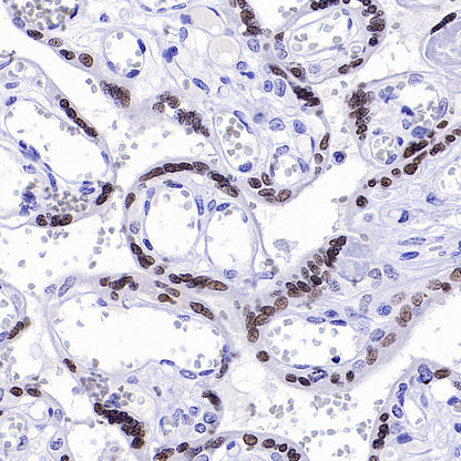 ATF3 Recombinant Rabbit mAb (S-3904)