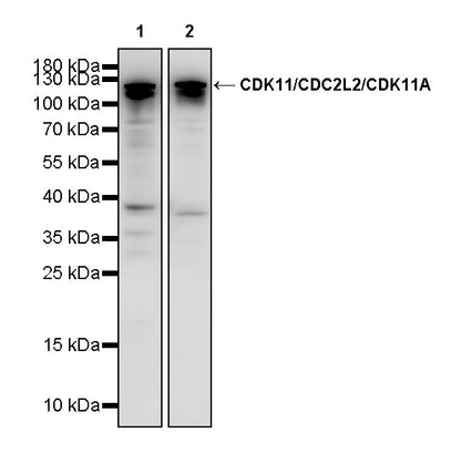 CDK11/CDC2L2/CDK11A Recombinant Rabbit mAb (S-3994-75)