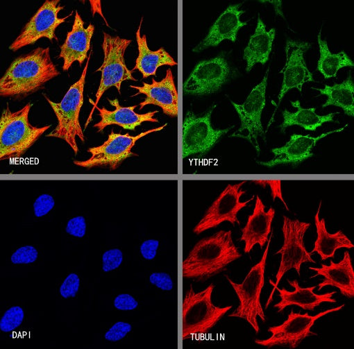 YTHDF2 Recombinant Rabbit mAb (S-1569-42)