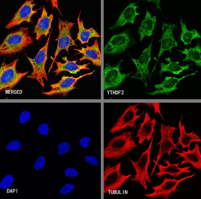 YTHDF2 Recombinant Rabbit mAb (S-1569-42)