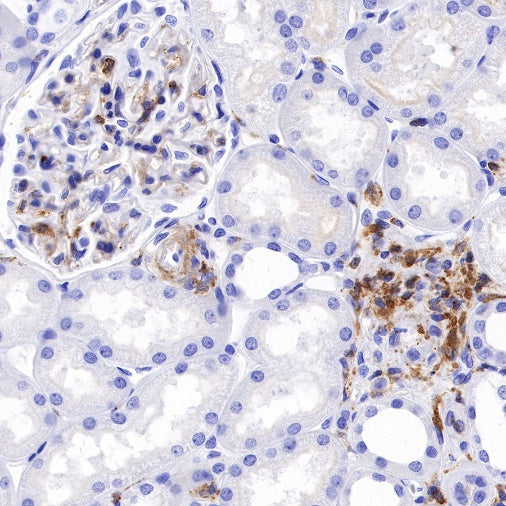 CSF-1R Recombinant Rabbit mAb (S-R219)