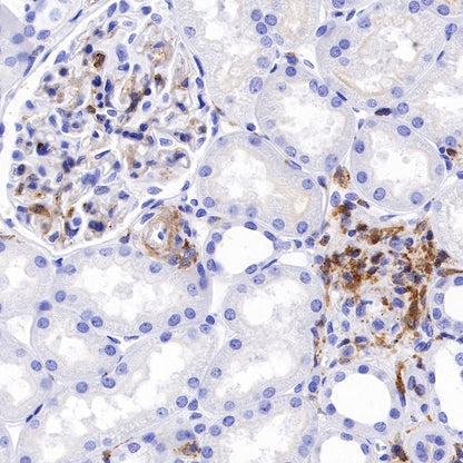 CSF-1R Recombinant Rabbit mAb (S-R219)