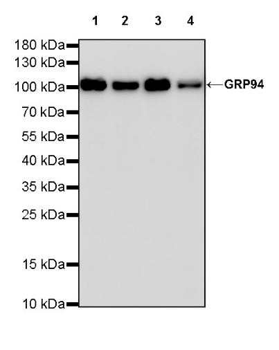 GRP94 Recombinant Rabbit mAb (S-R268)