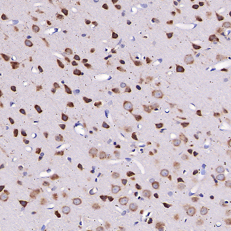 RPLP0 Rabbit Polyclonal Antibody