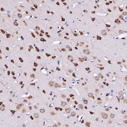 RPLP0 Rabbit Polyclonal Antibody