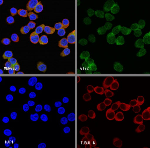 Gli2 Recombinant Rabbit mAb (S-2193-2)