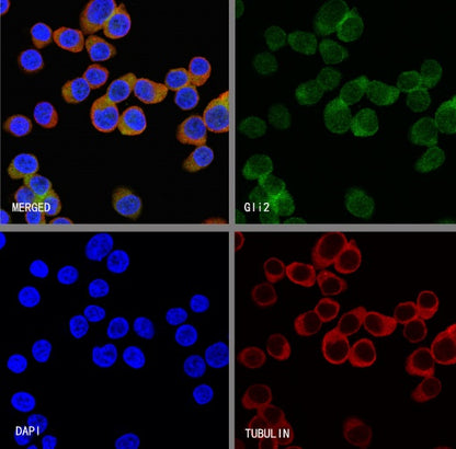 Gli2 Recombinant Rabbit mAb (S-2193-2)