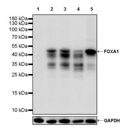 FOXA1 Recombinant Rabbit mAb, PBS Only  (SDT-2779-17)