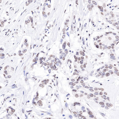 E2F4 Recombinant Rabbit mAb (S-586-214)