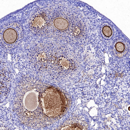 ZP3 Recombinant Rabbit mAb ,PBS Only(SDT-2201-35)