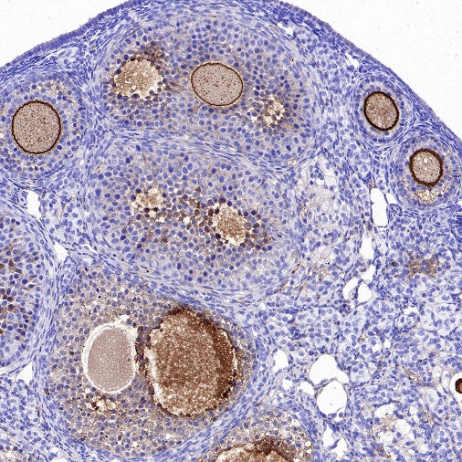 ZP3 Recombinant Rabbit mAb ,PBS Only(SDT-2201-35)