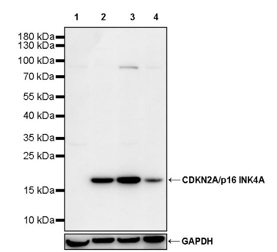 CDKN2A/p16 INK4A Recombinant Rabbit mAb (S-4676)