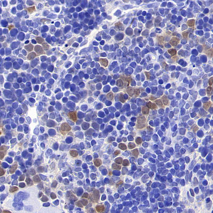 CDK6 Recombinant Rabbit mAb (S-4090-71)