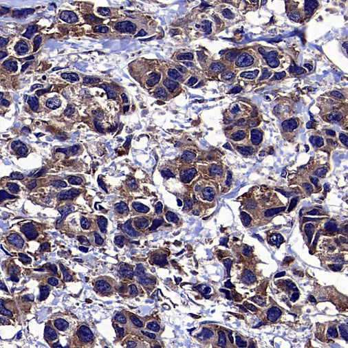 TRIM25 Recombinant Rabbit mAb (S-4069-59)
