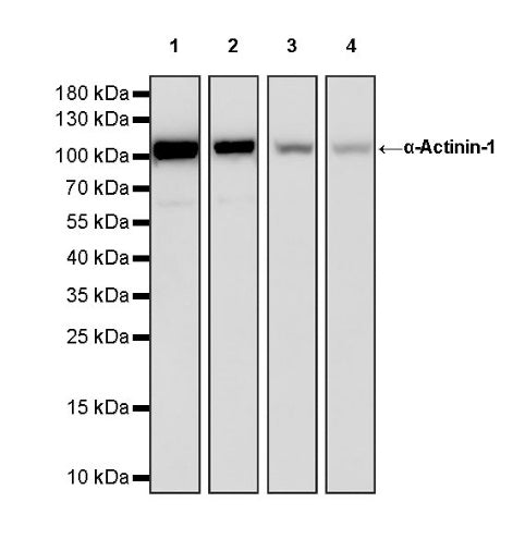 α-Actinin-1 Recombinant Rabbit mAb (HRP Conjugate) (SDT-311-20)