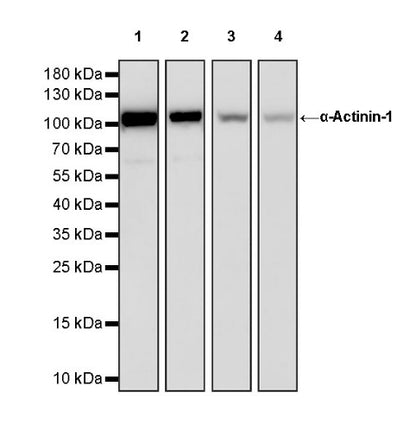 α-Actinin-1 Recombinant Rabbit mAb (HRP Conjugate) (SDT-311-20)