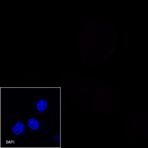 E-Cadherin Recombinant Rabbit mAb (Cy5 Conjugate) (S-438-5)