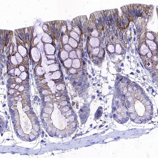 CD82 Recombinant Rabbit mAb (S-673-44)