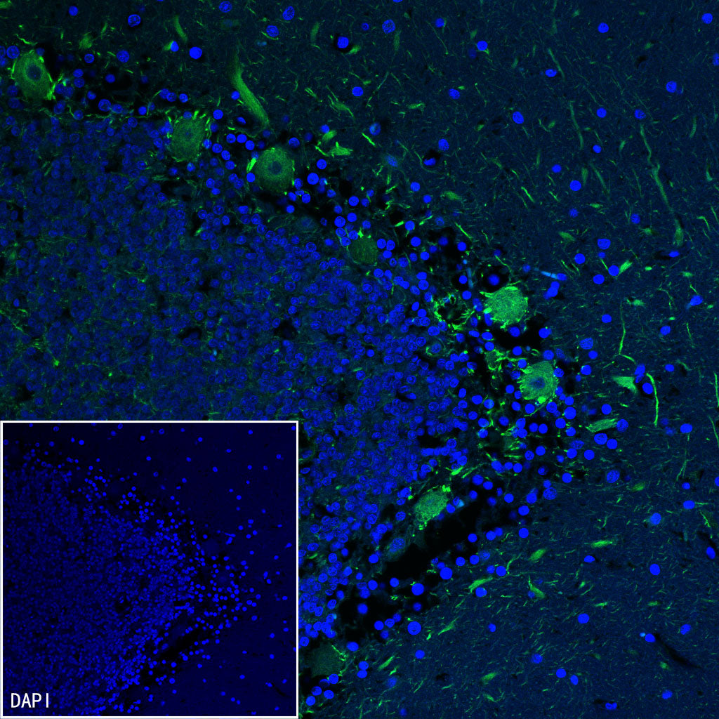Neurofilament M Recombinant Rabbit mAb (S-501-31)