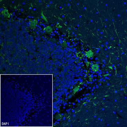 Neurofilament M Recombinant Rabbit mAb (S-501-31)