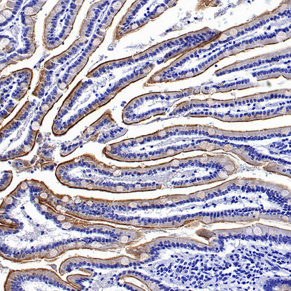 MUC17 Recombinant Rabbit mAb (SDT-3951-108)