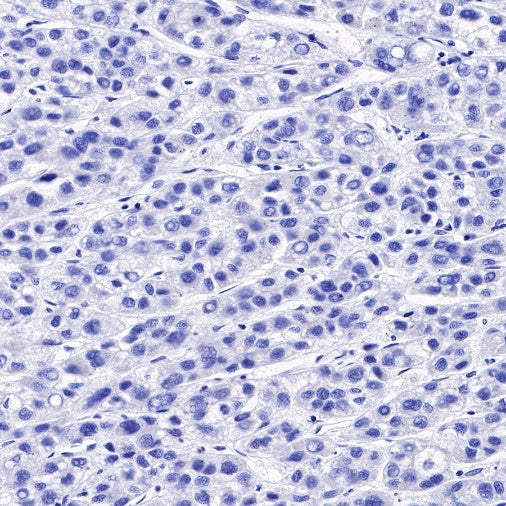 Uroplakin III Recombinant Rabbit mAb (SDT-R177)