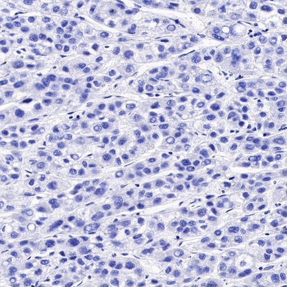 Uroplakin III Recombinant Rabbit mAb (SDT-R177)