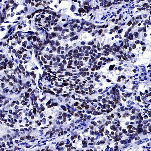 AP2α Recombinant Rabbit mAb (S-2376-7)