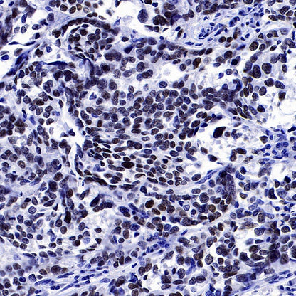 AP2α Recombinant Rabbit mAb (S-2376-7)