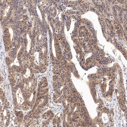 Caspase-3 Recombinant Rabbit mAb (S-656-43)
