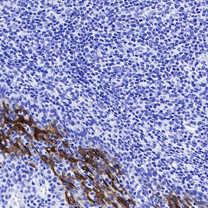 CK-13 Recombinant Rabbit mAb (SDT-R282)
