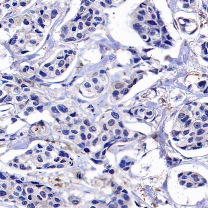 TRIM21 Mouse mAb (S-M0045)