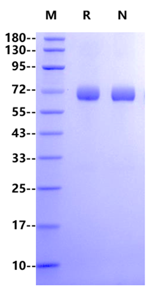 Angiopoietin-like 3/ANGPTL3 His Tag Protein, Human
