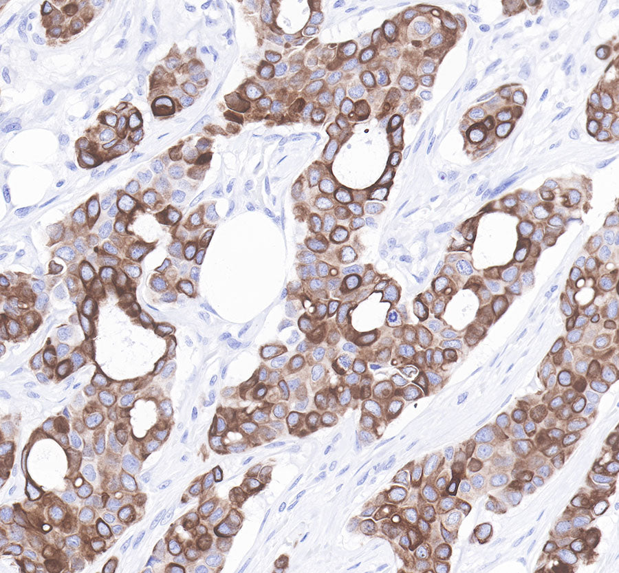 S-RMab® Cytokeratin 7 Recombinant Rabbit  mAb,PBS Only (SDT-121-17)
