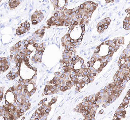 S-RMab® Cytokeratin 7 Recombinant Rabbit  mAb,PBS Only (SDT-121-17)