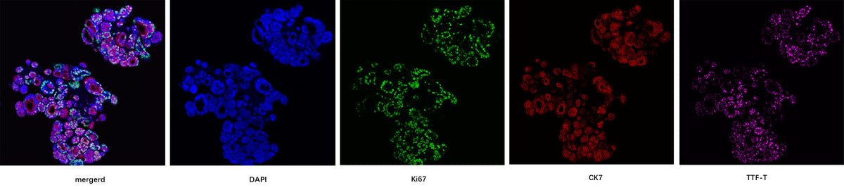 Noggin Protein, Human
