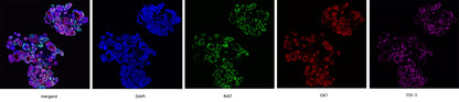 Noggin Protein, Human